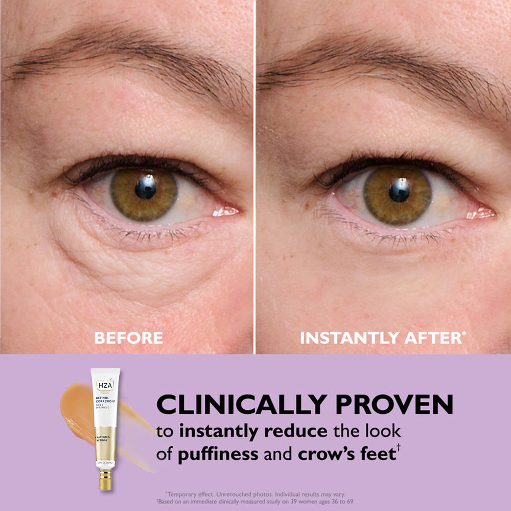 HZA™ Retinol Correxion Deep Wrinkle Facial Filler✨