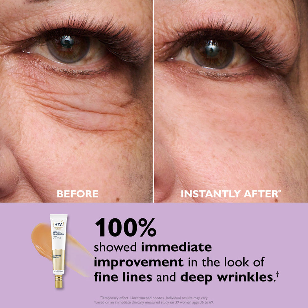 HZA™ Retinol Correxion Deep Wrinkle Facial Filler✨