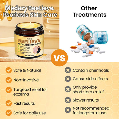 [✅Official Authorized Store] Medazy® BeeLieve Psoriasis Skin Care
